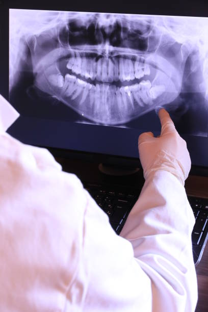 Best Emergency Root Canal Treatment in Hamtramck, MI